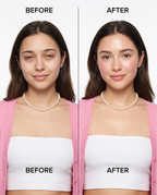 Zivol Frost before after de-puff comparison
